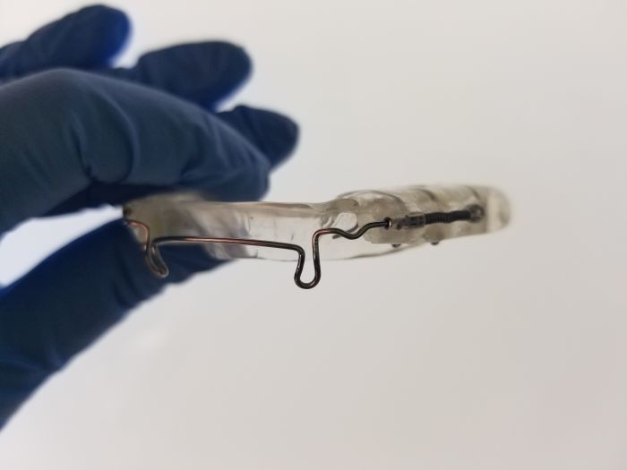 Aparelho foi desenvolvido pela cirurgiã dentista - Foto: Divulgação Aparelho foi desenvolvido pela cirurgiã dentista - Foto: Divulgação